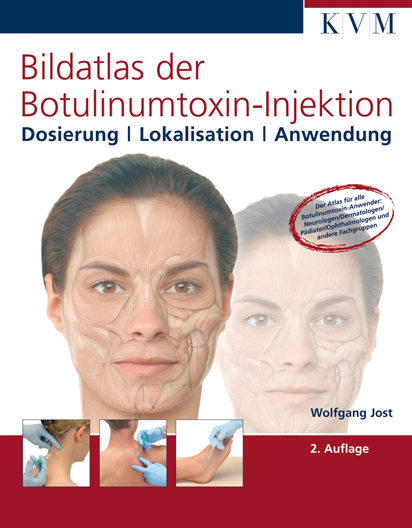 Bildatlas der Botulinumtoxin-Injektion - Wolfgang Jost