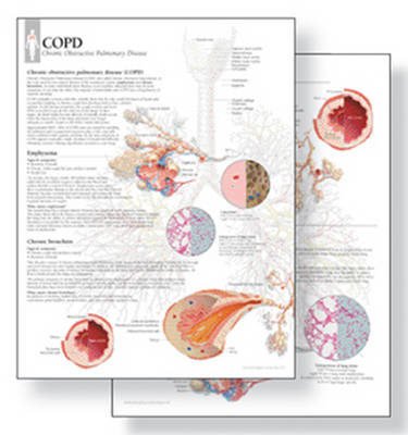 Understanding COPD Study Set Replacement Pads -  Scientific Publishing