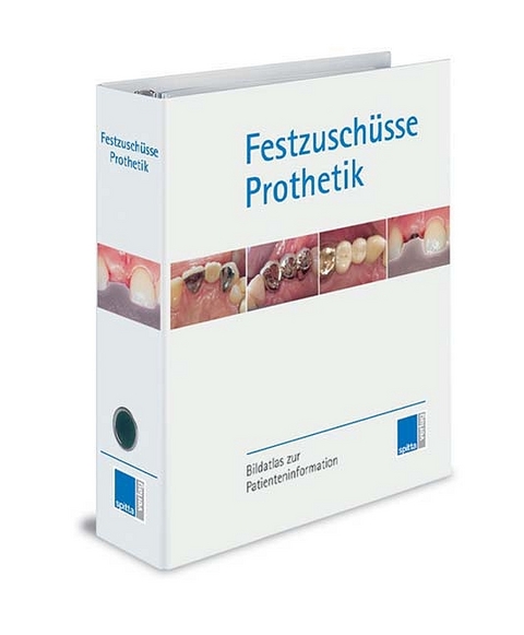 Festzuschüsse Prothetik - 