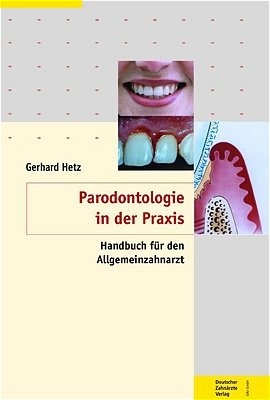 Parodontologie - evidenzbasierte Vorgehensweise - 