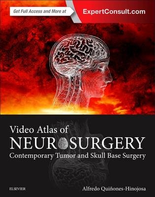 Video Atlas of Neurosurgery - Alfredo Quinones-Hinojosa