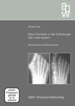 Neue Techniken in der Fußchirurgie - Das V-tek-System - Michael Vitek