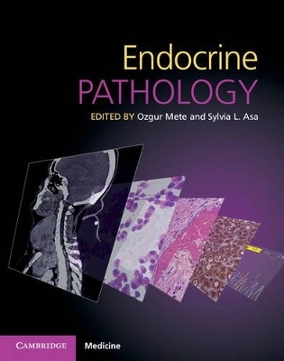 Endocrine Pathology with Online Resource - 