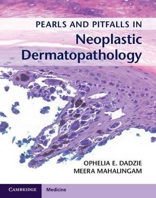 Pearls and Pitfalls in Neoplastic Dermatopathology with Online Access - 