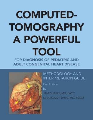 Computed-Tomography a Powerful Tool for Diagnosis of Pediatric and Adult Congenital Heart Disease - Facc Shakibi