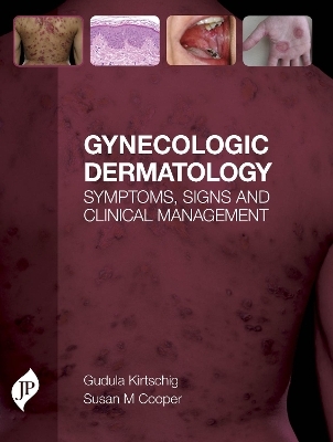 Gynecologic Dermatology - Gudula Kirtschig, Susan Cooper