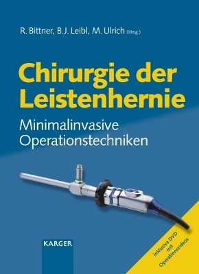 Chirurgie der Leistenhernie - 