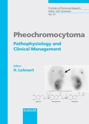 Frontiers of Hormone Research / Pheochromocytoma - 