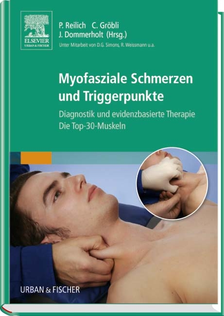 Myofasziale Schmerzen und Triggerpunkte - 