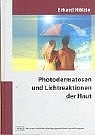 Photodermatosen und Lichtreaktionen der Haut - Erhard Hölzle