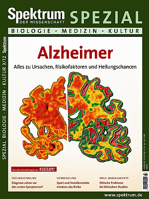 Alzheimer