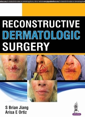 Reconstructive Dermatologic Surgery - S Brian Jiang, Arisa E Ortiz