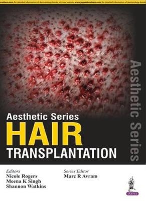 Aesthetic Series - Hair Transplantation - 