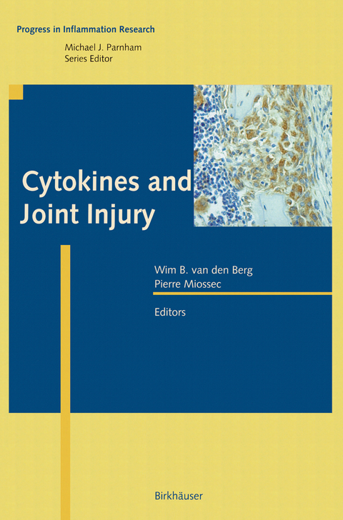 Cytokines and Joint Injury - 