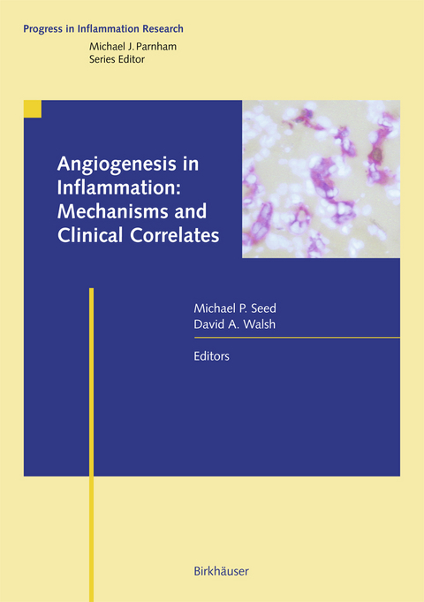 Angiogenesis in Inflammation: Mechanisms and Clinical Correlates - 
