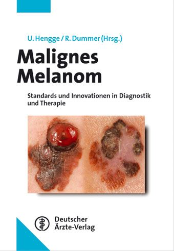 Malignes Melanom - Ulrich R Hengge, Reinhard Dummer