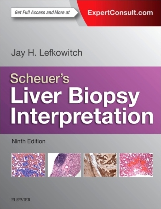 Scheuer's Liver Biopsy Interpretation - Jay H. Lefkowitch