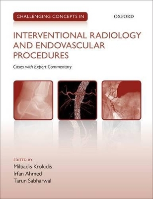 Challenging Concepts in Interventional Radiology - 