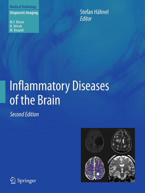 Inflammatory Diseases of the Brain - 