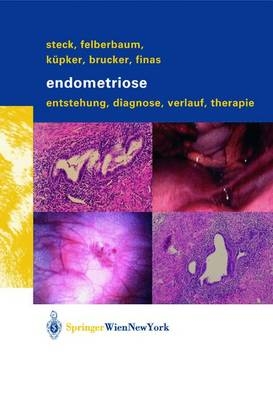 Endometriose - Thomas Steck, Ricardo Felberbaum, Wolfgang Küpker, Cosima Brucker, Dominique Finas