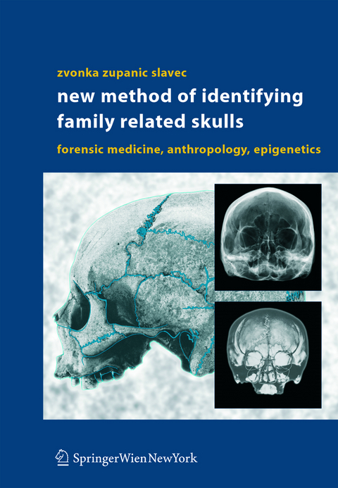New Method of Identifying Family Related Skulls - Zvonka Zupanic Slavec