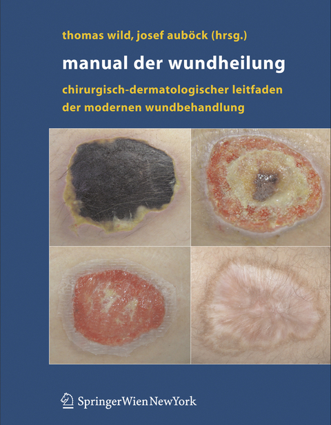 Manual der Wundheilung - 