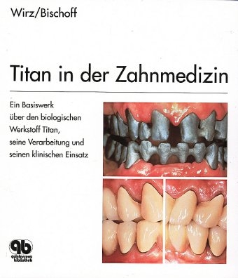 Titan in der Zahnmedizin - Jakob Wirz, Heiko Bischoff