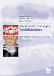 Genetisch bedingte Fehlbildungen im orofaziokranialen Bereich - Charlotte Opitz, Regine Witkowski, Sabine Tinschert
