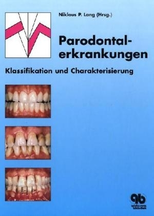 Parodontalerkrankungen - 