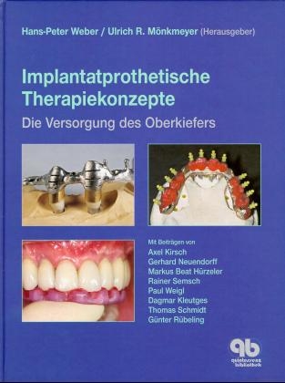 Implantatprothetische Therapiekonzepte - 