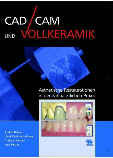 CAD/CAM und Vollkeramik - Kurt Reichel, Andreas Kurbad, Andres Baltzer, Vanik Kaufmann