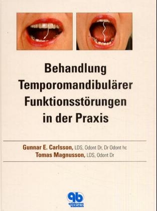 Behandlung Temporomandibulärer Funktionsstörungen in der Praxis - Gunnar E Carlsson, Tomas Magnusson