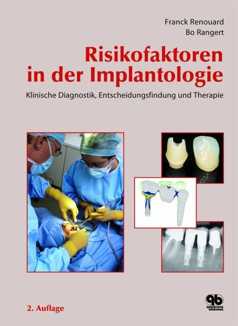 Risikofaktoren in der Implantologie - Franck Renouard, Bo Rangert
