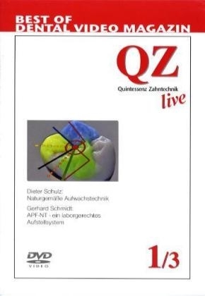 Quintessenz Zahntechnik live, 3 DVDs