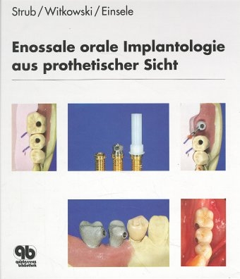 Enossale orale Implantologie aus prothetischer Sicht - Jörg R Strub, Siegbert Witkowski, Frank T Einsele