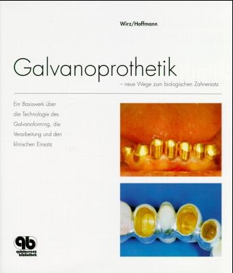 Galvanoprothetik - Jakob Wirz, Andreas Hoffmann