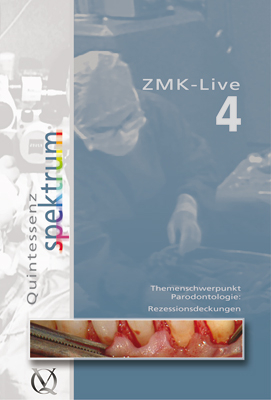 ZMK-Live 4 - G. Basting