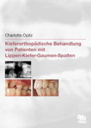 Kieferorthopädische Behandlung von Patienten mit Lippen-Kiefer-Gaumen-Spalten - Charlotte Opitz