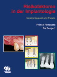 Risikofaktoren in der Implantologie - Franck Renouard, Bo Rangert