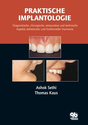 Praktische Implantologie - Ashok Sethi, Thomas Kaus