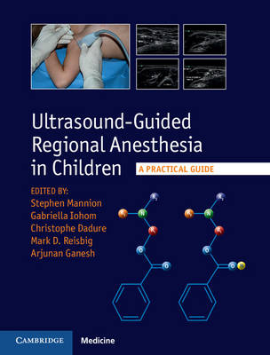 Ultrasound-Guided Regional Anesthesia in Children - 