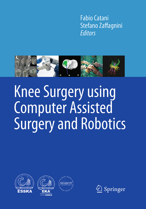 Knee Surgery using Computer Assisted Surgery and Robotics - 