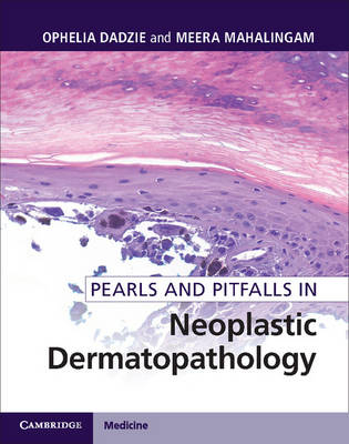 Pearls and Pitfalls in Neoplastic Dermatopathology - 