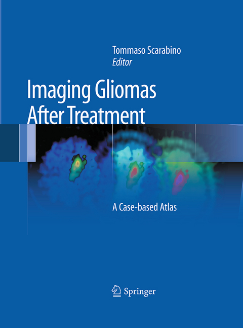 Imaging Gliomas After Treatment - 