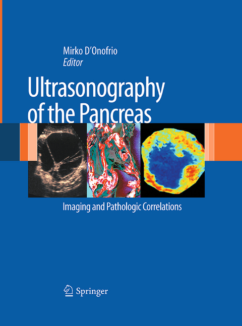 Ultrasonography of the Pancreas - 