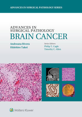 Advances in Surgical Pathology: Brain Cancer - Andreana Rivera, Hidehiro Takei