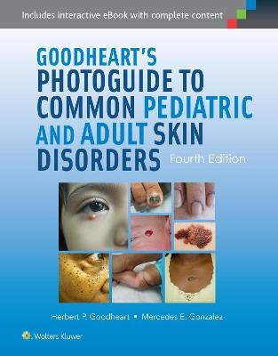 Goodheart's Photoguide to Common Pediatric and Adult Skin Disorders - Herbert Goodheart, Dr. Mercedes Gonzalez