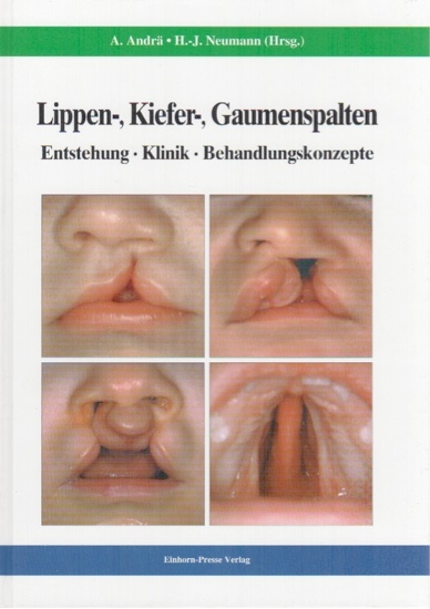Lippen-, Kiefer-, Gaumenspalten - Hans-Joachim Neumann