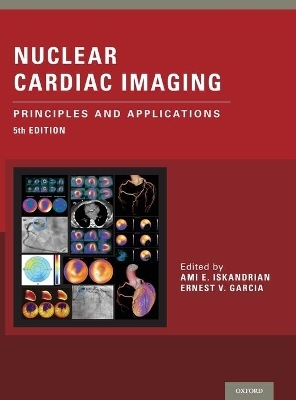 Nuclear Cardiac Imaging - 