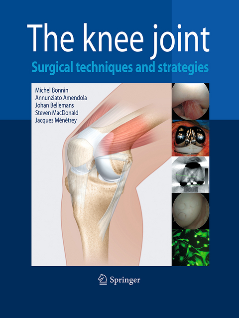 The Knee Joint - 